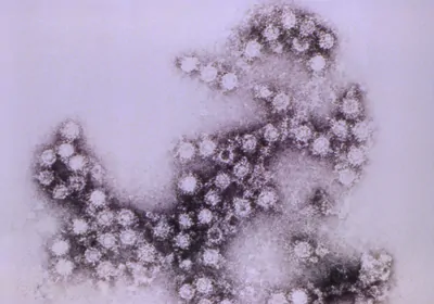 Microscopic image of a poliovirus